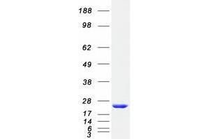 Western Blotting (WB) image for RAB31, Member RAS Oncogene Family (RAB31) protein (Myc-DYKDDDDK Tag) (ABIN2730326)