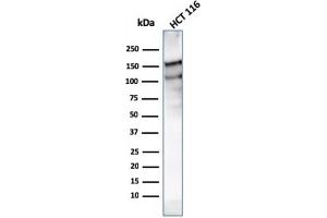 Western Blot Analysis of HCT116 cell lysate using MSH6 Mouse Monoclonal Antibody (MSH6/3091).