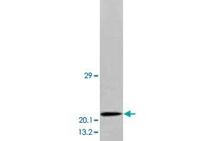 Western blot analysis of human brain tissue extracts with BDNF polyclonal antibody .
