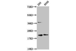 Western Blot Positive WB detected in: 293 whole cell lysate, A549 whole cell lysate All lanes: HIST1H1C antibody at 1:100 Secondary Goat polyclonal to rabbit IgG at 1/50000 dilution Predicted band size: 22 kDa Observed band size: 22 kDa (HIST1H1C antibody  (meLys45))