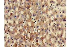 Immunohistochemistry of paraffin-embedded human liver tissue using ABIN7157444 at dilution of 1:100 (Cytokeratin 7 antibody  (AA 2-469))