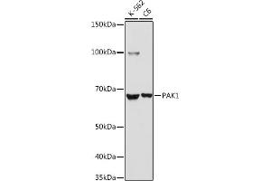 Western blot analysis of extracts of various cell lines, using P antibody (ABIN6130602, ABIN6145183, ABIN6145185 and ABIN6213991) at 1:1000 dilution. (PAK1 antibody  (AA 1-240))