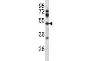Pdk4 antibody western blot analysis in mouse lung tissue lysate. (PDK4 antibody  (AA 82-110))