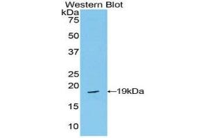 Western Blotting (WB) image for anti-Periostin (POSTN) (AA 659-810) antibody (ABIN1860276) (Periostin antibody  (AA 659-810))