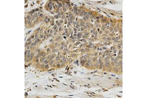 Immunohistochemistry (IHC) image for anti-Polo-Like Kinase 1 (PLK1) (AA 304-603) antibody (ABIN3023352)