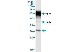 Immunoprecipitation of TMEM126B transfected lysate using anti-TMEM126B MaxPab rabbit polyclonal antibody and Protein A Magnetic Bead , and immunoblotted with TMEM126B MaxPab rabbit polyclonal antibody (D01) . (TMEM126B antibody  (AA 1-200))