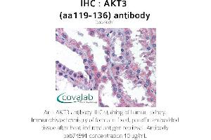 Image no. 2 for anti-V-Akt Murine Thymoma Viral Oncogene Homolog 3 (Protein Kinase B, Gamma) (AKT3) (AA 119-136) antibody (ABIN1731657) (AKT3 antibody  (AA 119-136))