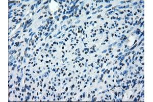 Immunohistochemistry (IHC) image for anti-SATB Homeobox 1 (SATB1) antibody (ABIN1500810) (SATB1 antibody)