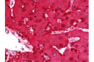Anti-DDH / AKR1C1 antibody IHC staining of human liver. (AKR1C1 antibody  (AA 22-248))