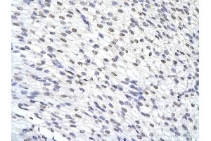 Rabbit Anti-ZFP36 antibody        Paraffin Embedded Tissue:  Human Heart cell   Cellular Data:  Epithelial cells of renal tubule  Antibody Concentration:   4. (ZFP36 antibody  (N-Term))