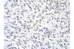 Rabbit Anti-ZFP36 antibody        Paraffin Embedded Tissue:  Human Heart cell   Cellular Data:  Epithelial cells of renal tubule  Antibody Concentration:   4. (ZFP36 antibody  (N-Term))