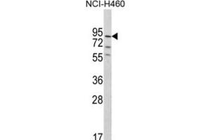 PLEKHG6 antibody