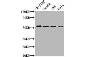 Western Blot Positive WB detected in: SH-SY5Y whole cell lysate, HepG2 whole cell lysate, 293 whole cell lysate, Hela whole cell lysate All lanes: SLC19A3 antibody at 3.