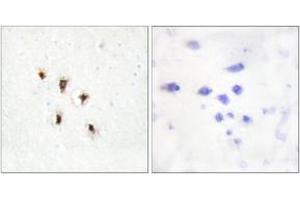 Immunohistochemistry analysis of paraffin-embedded human brain tissue, using Mevalonate Kinase Antibody. (MVK antibody  (AA 151-200))