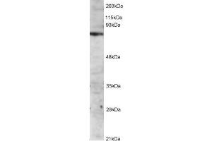 Western Blotting (WB) image for IL2-Inducible T-Cell Kinase (ITK) peptide (ABIN369790)