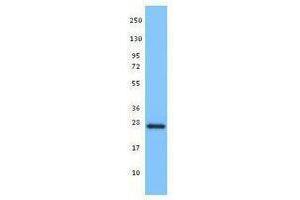 Western Blotting (WB) image for anti-BH3 Interacting Domain Death Agonist (BID) antibody (ABIN2666317) (BID antibody)