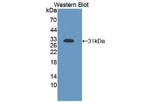 Western blot analysis of recombinant Human ETFb. (ETFB antibody  (AA 2-255))