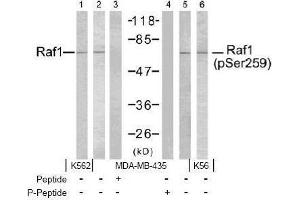 Image no. 2 for anti-V-Raf-1 Murine Leukemia Viral Oncogene Homolog 1 (RAF1) (Ser259) antibody (ABIN197103) (RAF1 antibody  (Ser259))