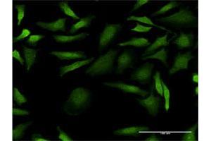 Immunofluorescence of monoclonal antibody to CDC2 on HeLa cell. (CDK1 antibody  (AA 211-297))