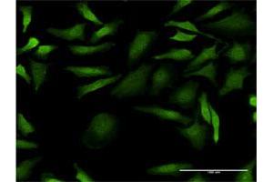 Immunofluorescence of monoclonal antibody to CDC2 on HeLa cell.