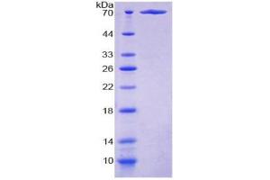 Image no. 1 for KIAA1524 (KIAA1524) (AA 230-560) protein (His tag,GST tag) (ABIN6239996) (KIAA1524 Protein (KIAA1524) (AA 230-560) (His tag,GST tag))