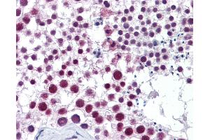 Anti-CCNH / Cyclin H antibody IHC of human testis. (Cyclin H antibody  (AA 1-110))