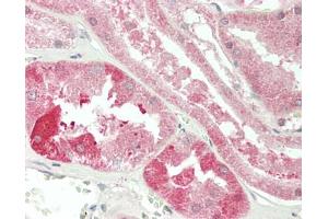 Human Kidney: Formalin-Fixed, Paraffin-Embedded (FFPE). (LYPLA2 antibody  (Biotin))