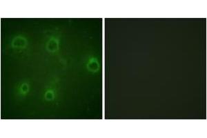 Immunofluorescence analysis of COS7 cells, using IL-8R beta/CDw128 beta (Phospho-Ser347) Antibody. (CXCR2 antibody  (pSer347))