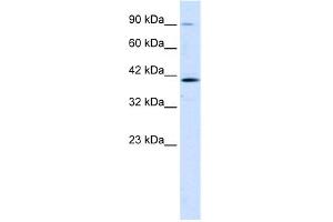 WB Suggested Anti-CCDC16 Antibody Titration:  1. (CCDC16 antibody  (Middle Region))