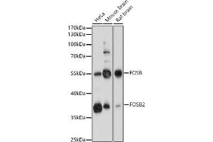 Western blot analysis of extracts of various cell lines, using FOSB antibody (ABIN7267159) at 1:1000 dilution. (FOSB antibody  (AA 1-100))