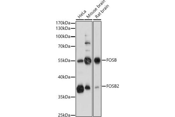 FOSB 抗体  (AA 1-100)