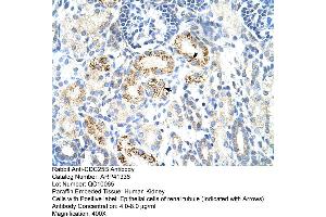 Immunohistochemistry (IHC) image for anti-Cell Division Cycle 25 Homolog B (S. Pombe) (CDC25B) (N-Term) antibody (ABIN2776752)