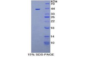 SDS-PAGE (SDS) image for Aquaporin 2 (Collecting Duct) (AQP2) (AA 177-271) protein (His tag,GST tag) (ABIN2122453)