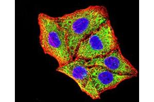 Immunocytochemistry (ICC) image for anti-BCL2/adenovirus E1B 19kDa Interacting Protein 3 (BNIP3) (AA 50-155) antibody (ABIN5858883) (BNIP3 antibody  (AA 50-155))