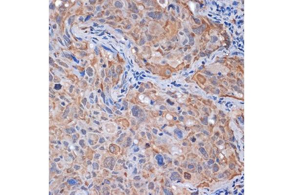 PPP2CB antibody