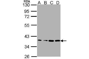 WB Image Sample(30μg whole cell lysate) A: A431 , B: H1299 C: HeLaS3 D: MOLT4 , 12% SDS PAGE antibody diluted at 1:1000