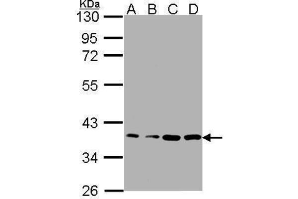 RPL5 anticorps