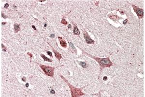 Staining of paraffin embedded Human Cerebral Cortex using MOBKL3 antibody at 5 µg/ml. (MOBKL3 antibody  (Internal Region))