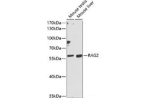 Western blot analysis of extracts of various cell lines using RAG2 Polyclonal Antibody at dilution of 1:1000. (RAG2 antibody)