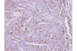 anti-Zinc Finger, DHHC-Type Containing 11 (ZDHHC11) antibody