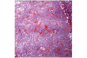 Immunohistochemistry (IHC) image for anti-CD84 (CD84) antibody (ABIN1106590) (CD84 antibody)