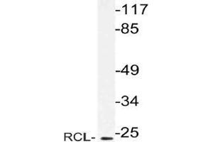 Western blot (WB) analysis of RCL antibody in extracts from Jurkat cells. (RCL antibody)