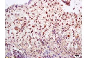 Formalin-fixed and paraffin embedded mouse embryo labeled with Rabbit Anti CDCA5/Sororin Polyclonal Antibody, Unconjugated (ABIN872622) at 1:200 followed by conjugation to the secondary antibody and DAB staining (CDCA5 antibody  (AA 101-200))