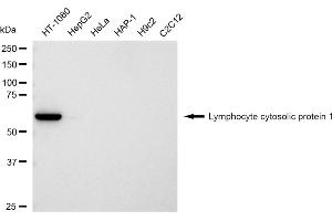 Western blotting analysis using Lymphocyte cytosolic protein 1 antibody (ABIN7799292).