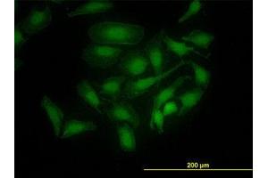 Image no. 4 for anti-PDZ Binding Kinase (PBK) (AA 1-110) antibody (ABIN599274) (PBK antibody  (AA 1-110))