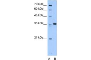 Western Blotting (WB) image for anti-Aminoadipate-Semialdehyde Dehydrogenase-phosphopantetheinyl Transferase (AASDHPPT) antibody (ABIN2463215)