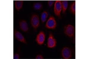 Image no. 2 for anti-Ribosomal Protein S6 (RPS6) (AA 233-237) antibody (ABIN197470) (RPS6 antibody  (AA 233-237))