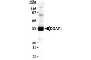 Western blot analysis of DGAT1 in HepG2 lysate using DGAT1 polyclonal antibody . (DGAT1 antibody  (AA 200-300))