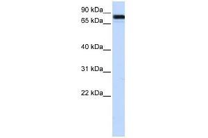 EWSR1 antibody used at 1 ug/ml to detect target protein. (EWSR1 antibody  (Middle Region))