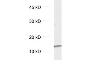 dilution: 1 : 5000, sample: rat brain homogenate (PVALB antibody)